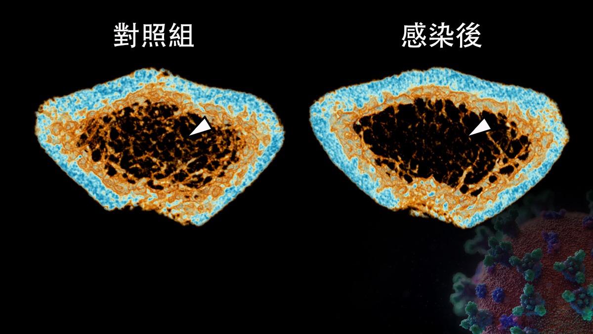 港大醫學院發現感染新冠病毒可致敘利亞倉鼠嚴重炎性骨質流失