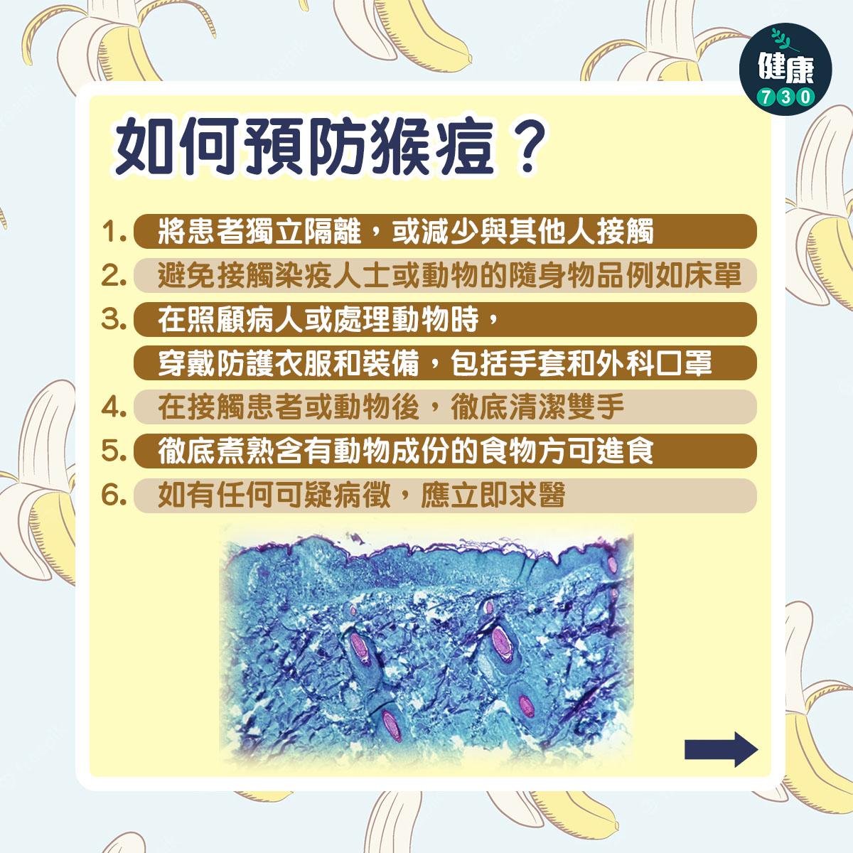 如何預防猴痘?