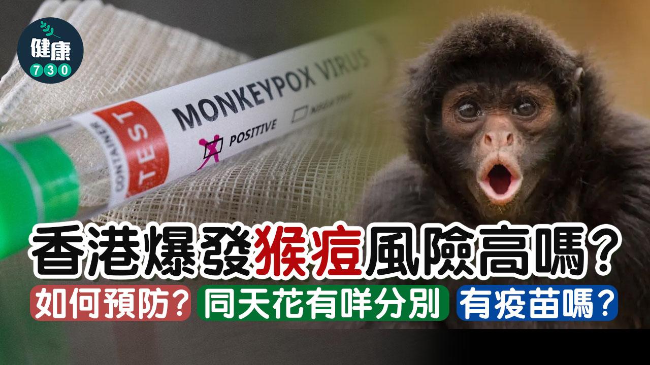 猴痘病毒|症狀是甚麼?源頭是否來自猴子?如何治療?香港有猴痘疫苗嗎?