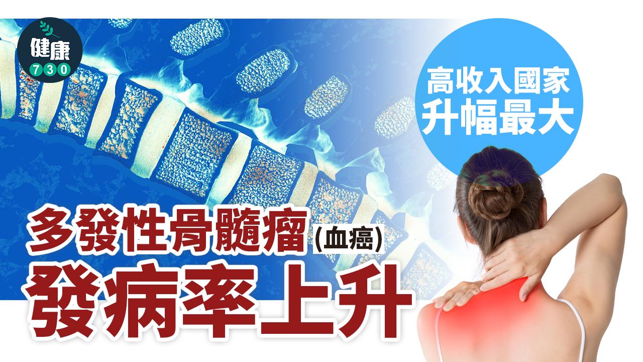 血癌|多發性骨髓瘤發病率上升 高收入國家升幅最大