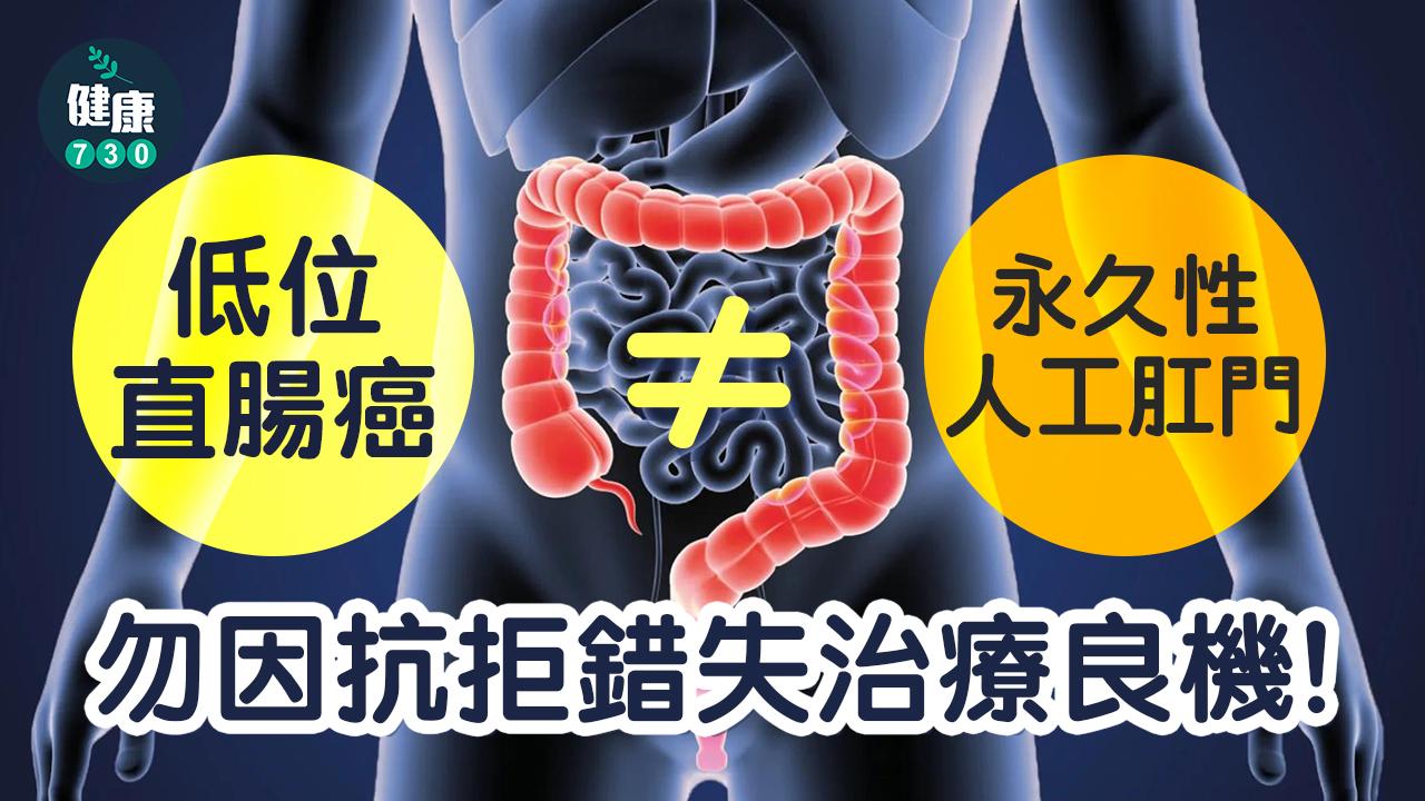 低位直腸癌≠永久性人工肛門 勿因抗拒錯失治療良機!
