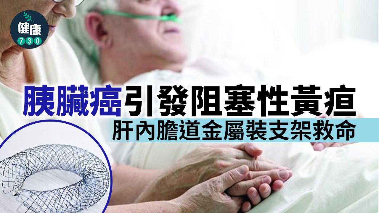 75歲張姓老翁年初因腹痛、食慾降低且體重下降就醫,檢查後赫然罹患胰臟癌,且癌細胞擴散到肝臟,後續又出現阻塞性黃疸,醫療團隊評估後,決採用「膽道金屬雙支架」引流阻塞膽汁。