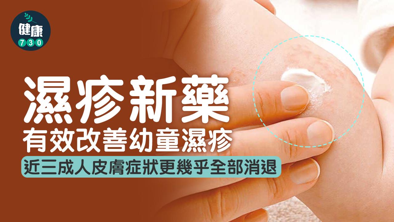 濕疹新藥 兒童研究:改善逾75%