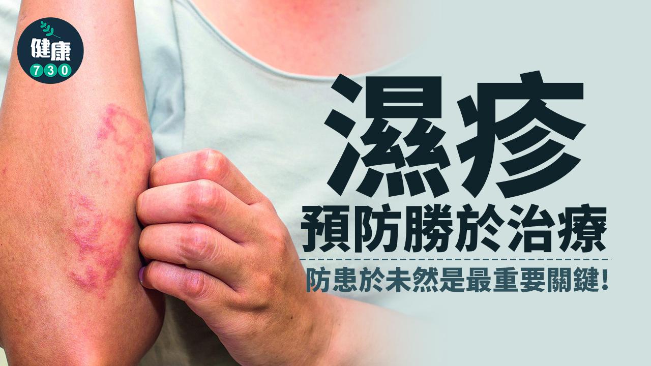 對抗異位性皮膚炎是的確是需要長期抗戰,於是邱品齊醫師呼籲,最好的方式就是從嬰幼兒期一發病,就要及早治療處理以阻斷發炎過程。