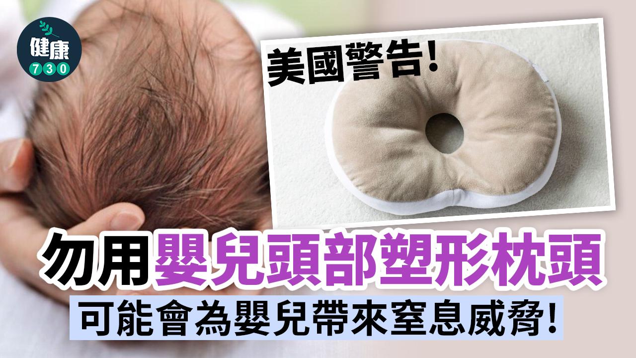 嬰兒|美國警告 勿用嬰兒頭部塑形枕頭