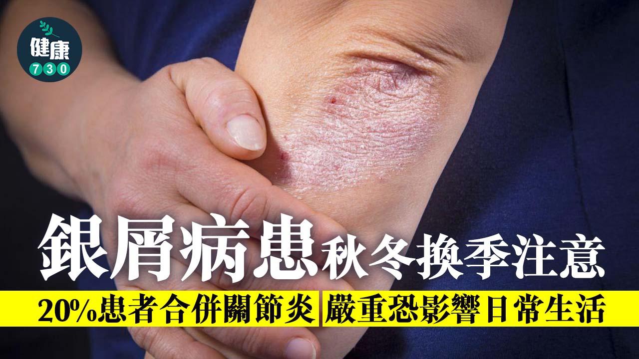 正逢秋冬季節,天氣較於乾燥加上缺乏紫外線,導致較難抑制免疫反應,因此也是進入銀屑病症狀容易復發時期,除了靠平時保養,在治療上,如何將發炎反應抑制下來才是關鍵。