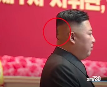 金正恩翌日在另一公開場合上,後腦的膠布已經撕走,皮膚呈現黑色。(互聯網)