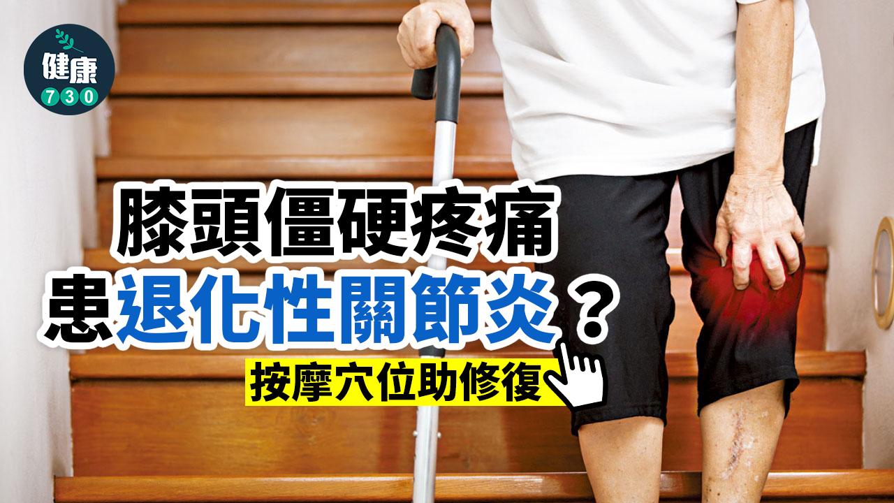 關節炎 膝頭僵硬疼痛患退化性關節炎 Am730