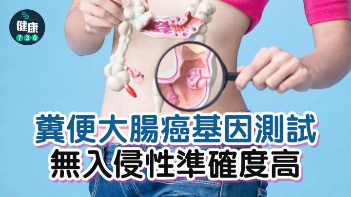 糞便大腸癌基因測試 無入侵性準確度高